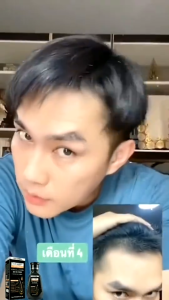 แชมพูขิงช่วยขจัดความมันและรังแค บำรุงรากผม ปลูกผมอย่างอ่อนโยน 250ml สูตรน้ำขิง แชมพูแก้ผมร่วง  ปกป้องหนังศีรษะ ป้องกันผมร่วง และดูแลเส้นผม