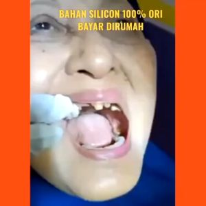 Venner White Gigi Palsu not snap on smile Perapih Gigi Instan ORIGINAL 100%