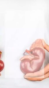 JUS TIYARA ORIGINAL HQ MERAWAT BUAH PINGGANG KERING BOCOR ROSAK MENGGUNAKAN HERBA TERPILIH