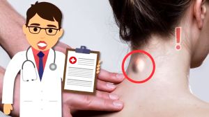 Janpanese Original Lipoma Removal Cream Tendon sheath cyst removing ointment Fat Lump Removal Dredge