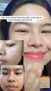 See It Glow Serum Tranexamic Acid Niacinamide Ceramide Aloe vera Salicylic Acid Hyaluronic Glycolic