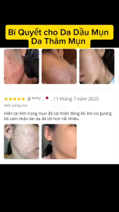 Serum Trị Mụn Trứng Cá Mụn Đầu Đen Chiết Xuất Thực Vật DR.XME 10ml - Tinh Chất Mờ Thâm Mụn Kiềm Dầu Chăm sóc Da Mụn
