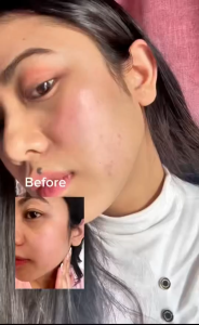 MEDICUBE Zero Pore Cream 2.0 50ml - Pore Cream for Pore Visibility & Sebum/Moisture Balance