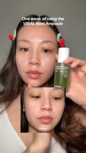 【พิเศษ】Celimax (เซลลีแมกซ์) แอมพูลนอนิเอเนอร์จีแท้ 30มล. - ฟื้นฟูผิว กู้หน้าโทรม