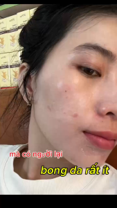 Combo Dn Plus Cải Tiến 20g Hỗ Trợ Chăm Sóc Da