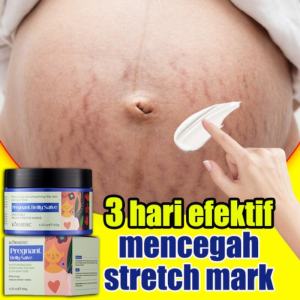 Stretch Mark Cream 120g Penghilang Strechmark Ampuh Permanen Removal Stretch Mark Dan C-Section Scars Penghilang Stretch Mark Ampuh Krim Perawatan Postpartum