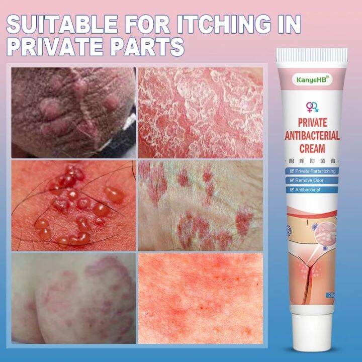 Psoriasis Treat Cream Genitals Vulva Eczema Dermatitis Ointment Rash ...