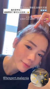 HEXPERT PREMIUM SCALP CARE TONIC Anti-Hair Loss Controls Hair Fall & Increase Hair Growth