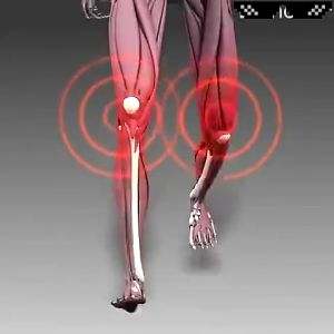 Kem nọc ong Hỗ Trợ Giảm Đau Khớp Viêm Khớp Đau Lưng Mỏi Gối Đau Cổ Vai Gáy