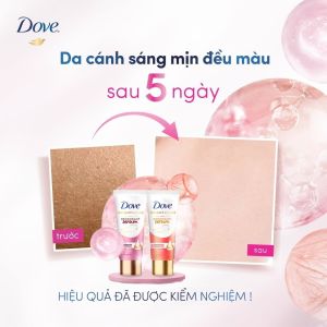 Kem Khử Mùi Dove Dry Serum Sáng Mịn Đều Màu Dove Radiant + Care Even Tone Deep Renew Dry Serum Deodorant 50ml