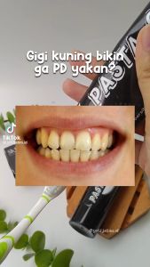 Pasta Gigi SR12 Perontok Karang Gigi Odol Pemutih Gigi