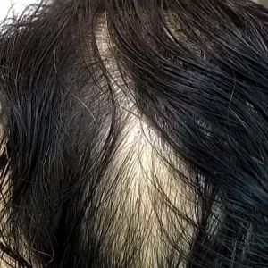 Perawatan Rambut: Serum Penebal Rambut & Essential Oils Penumbuh Rambut