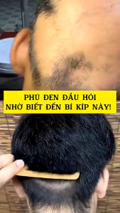 Dầu gội DHT 250ml kích thích mọc tóc giảm gàu nấm ngứa bảo vệ nang tóc chắc khỏe