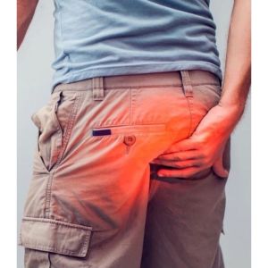 Hemorrhoid cream 20g hemorrhoid root break hemorrhoid cream fissured internal and external hemorrhoids mixed hemorrhoids eliminate meatballs