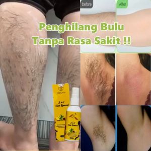 Meuvy Hair Removel 3 in 1: Kinclong Bulu Langsung Hilang