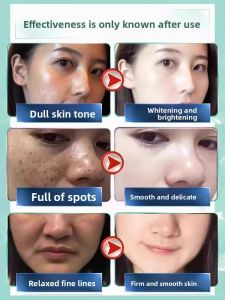 ORKY | Yunnan Herbal Whitening Spot-removing Cream for Yellow Skin