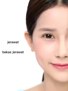 AHA&BHA&PHA Balancing Essential Oil Essence 30ml Facial Exfoliating Essence | Mengecilkan Pori-pori Mengontrol Minyak dan Melembabkan Essence | Mencerahkan Kulit Mengatasi Jerawat Mengatasi Flek Hitam Mengatasi Komedo