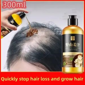 Shampoo Penumbuh Rambut Cepat & Anti Rambut Rontok: Botak Ginger Shampoo 300ml