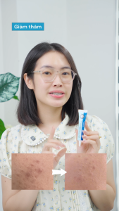 Gel chấm ngừa mụn và thâm Spot Clear Derma Calm 12H giảm mụn sau 12H sử dụng hiệu quả tối ưu 15gr