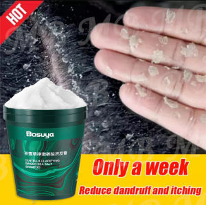 【Cleansing Abundance】anti dandruff shampoo anti kelemumur dan rambut gugur dandruff shampoo dandruff treatment shampoo sea salt shampoo抗头皮屑洗发水头皮屑控油