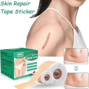Silicone Scar Sheets Scar Patch Scar Tape Silicone Gel Acne Keloid Burn C Section Reusable Washable 10PCS