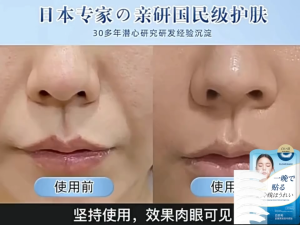 Nasolabial Folds Mask Anti Wrinkle Patch No-wash Sleeping Mask 18pcs Remove Face Eye Wrinkles