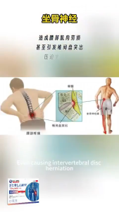 【Fast Effective 】Japan sciatica pain relief patch back arthritis pain relief Lumbar Spine 坐骨神经痛