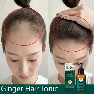 Skinvise Hair Tonic For Hair Growth Serum Ginger Hair Growth Tonic Herbal Ginger Essence Anti Prevent Hair Loss Nourishing Care