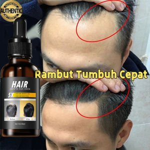 Pertumbuhan rambut penumbuh rambut cepat serum penumbuh rambut botak serum rambut rontok rusak 30ml penumbuh rambut cepat rambut rontok dewasa