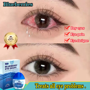 （Buy 1 Take 1）Original Blueberries Eye Drops for Clear Vision Dry Eyes Congestion Eyes Blurry Eyes Red Eye Sore Eyes Blurry Eyes Itchy Eyes Relieve Fatigue Effective Mitigation Dry Eyes15g