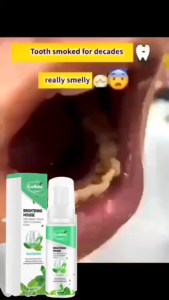 Foam Pembersih Gigi dengan Sensasi Mint Dingin Perontok Karang Gigi Paling Ampuh! Mengangkat Noda Kuning Mengurangi Bau Mulut dan Membantu Mencerahkan Gigi dengan Cepat. Praktis Dipakai Cukup Semprot dan Bilas. Mulut Segar Sepanjang Ha Mencerahkan Sen