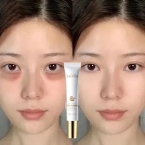 Snail Eye Cream untuk Keriput dan Kantung Mata