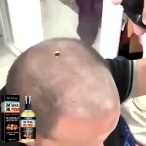 简素净 | Fast Hair Growth Set Batana Oil Traction Alopecia Hair Mask Anti Break Loss Hair Growth Oil Baldness Treatment Hair Health Care