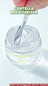 [ Promo ] GLAD2GLOW KIWI 3D ACID ACNE MOISTURIZER Pelembab Wajah Jerawat Day & Night Cream Skincare