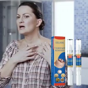 EELHOE Wart Remover Pen Krim Penghilang Lalat Krim Penghilang Kutil Mudah Dibawa Untuk Semua Kulit Krim Penghilang KutilWart Removal Cream