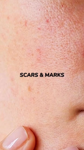 [BPOM] KORMESIC Gel Eksfoliasi Wajah Cerah & Halus / Gel Eksfoliasi Wajah Pomegranate 100g