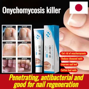 🫧【50% off special price】🫧Botanical extracts Nail Care Products Gray Nail Polish Repairing nails Thickening no recurrence