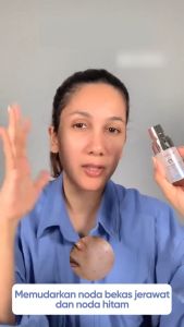 Serum noda hitam | 17 SymWhite 377 Dark Spot Serum 20ml | Penghilang Flek Hitam Mencerahkan Kulit Brightening Serum Pencerah Wajah | BPOM