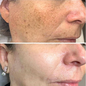 Facial Essence Serum Skincare Anti Aging Wrinkle Control Anti-oxidation Liquid Nicotinamide Whitening 30ml Brightening skin Moisturizing Whitening Essence