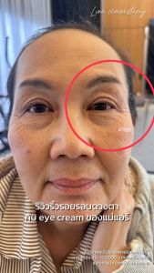 CESUN Frozen Age Anti-Wrinkle Eye Cream 30ml. - เซซุน อายครีม ลดเลือนริ้วรอยรอบดวงตา ขนาด 30 กรัม