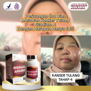 Regnazel Nakara - Obat Tumor & Kanker Herbal