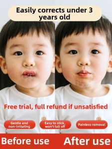 Baby Lip Sucking Device Anti-Bite Lower Lip Children Sleeping Bite Mouth Correction Lift Baby Health Care Equipment