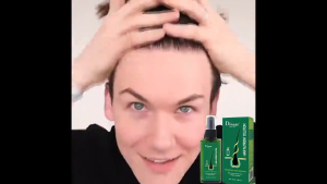 Spray Penumbuh Rambut Cepat 100ml- Anti Rontok Parah & Regenerasi Folikel Obat rambut botak penumbuh rambut botak serum serum rambut rontok Cepat Anti Rontok Mengatasi Botak Obat Botak Vitamin Rambut Hair Care