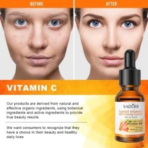 Vitamin C Serum Pelembab Menyegarkan Perawatan Kulit Serum Karoten Perawatan Kecantikan Anti Penuaan Perawatan Jerawat