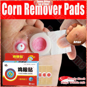 🚀SG stock🚀 Corn removal plaster / Painless removal chicken eye / Corn remover / Foot calluses remover / Corn removal / 鸡眼膏 / 鸡眼贴