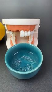 Penambal Gigi Sementara: Solusi untuk Gigi Ompong, Berlubang & Patah