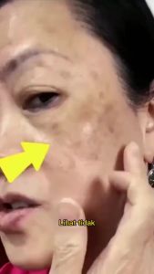 FUYAN WHITENING FRECKLE REMOVING CREAM/UNTUK FLEK HITAM