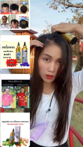 ชุดบำรุงผม สูตรลดร่วง ลดหงอก (แชมพู1 เซรั่ม1)