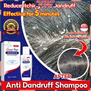 ❤️SG stock❤️ Coal tar shampoo / Antibacterial oily scalp shampoo / Anti dandruff shampoo / Psoriasis scalp itchy scalp shampoo / 煤焦油洗发水