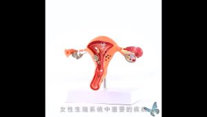 Uterus Model Pathological Uterus Ovary Anatomical Model Ovary Anatomy Cross Section Study Tool